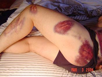 En 29 semanas del dolor en los riñones y en los pies
